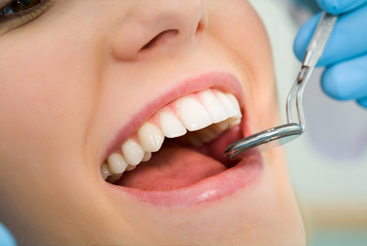 Dental Hygiene (Scale & Polish)