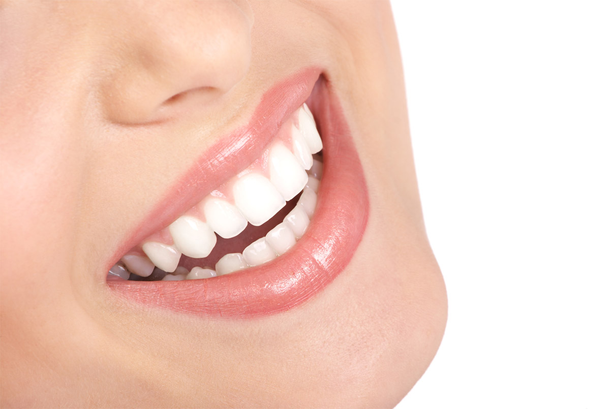 Tooth Whitening